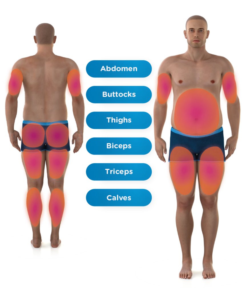Front and back side of a man with areas highlighted including Abdomen, buttocks, thighs, biceps, triceps, and calves.
