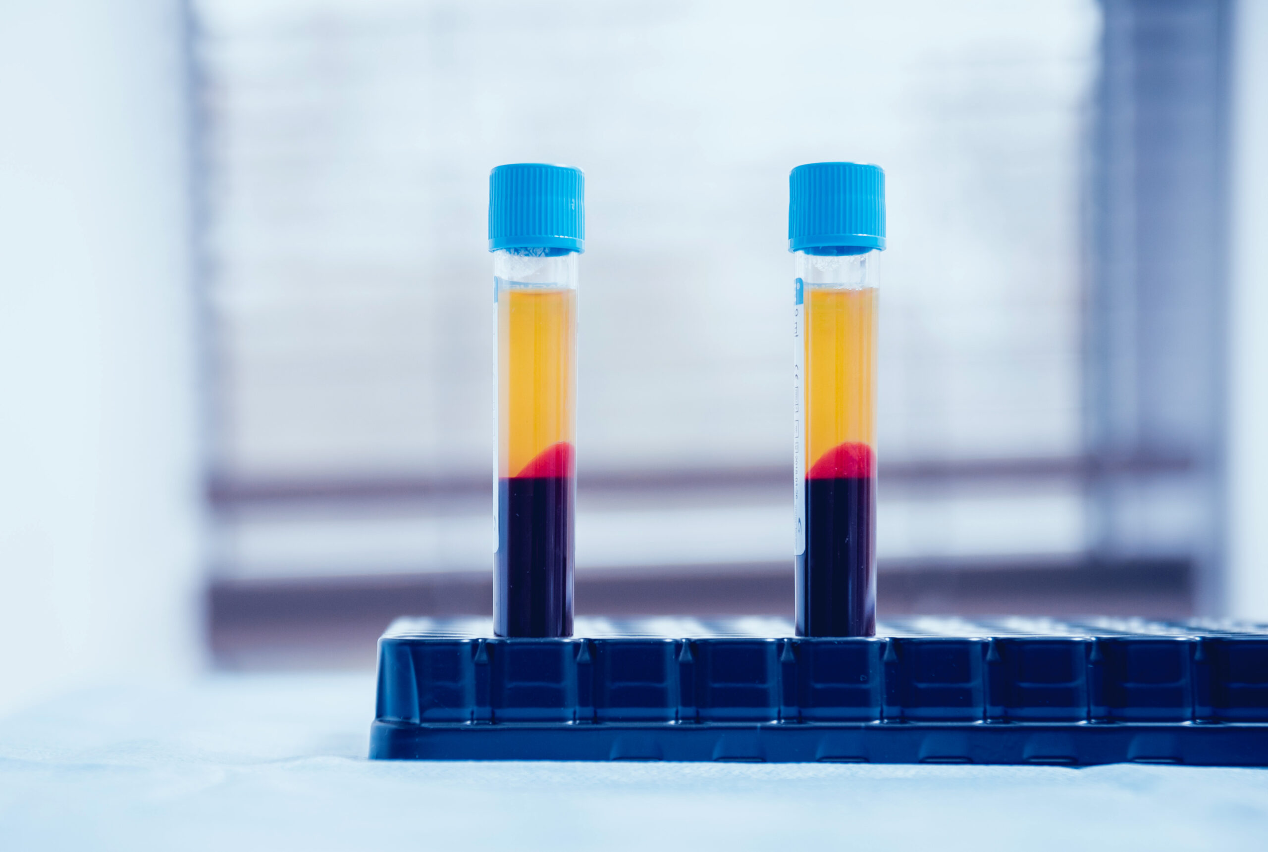 Read more about the article Platelet Rich Plasma (PRP) as an Adjunctive Intervention to Conventional Testosterone and Erectile Dysfunction Medication for Men with Sexuality Concerns: Preliminary Responder Analysis