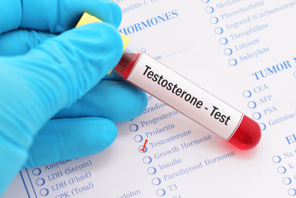 Read more about the article Low Testosterone: Free vs. Total Testosterone Levels